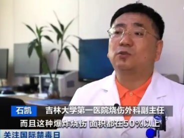 全国多地青少年丁烷滥用成灾,呼吸道爆燃致残率超 10%